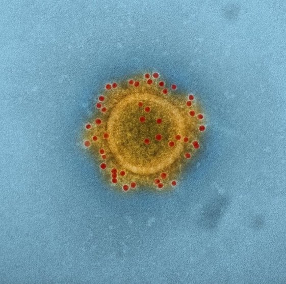 coronavirus_caso_España-700x696