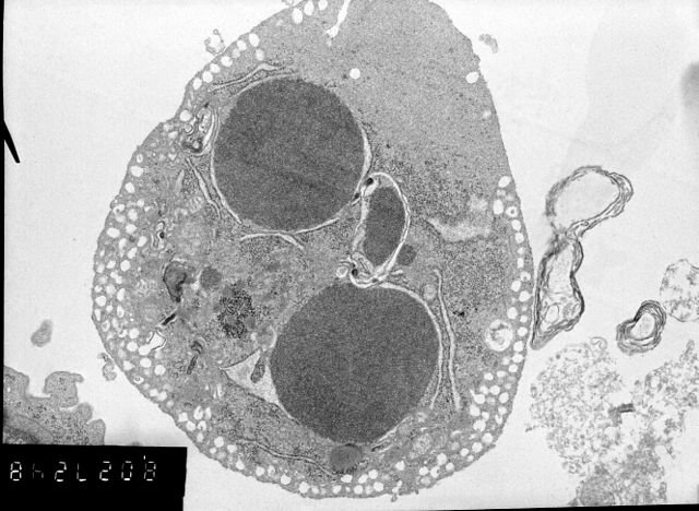 Apoptosis