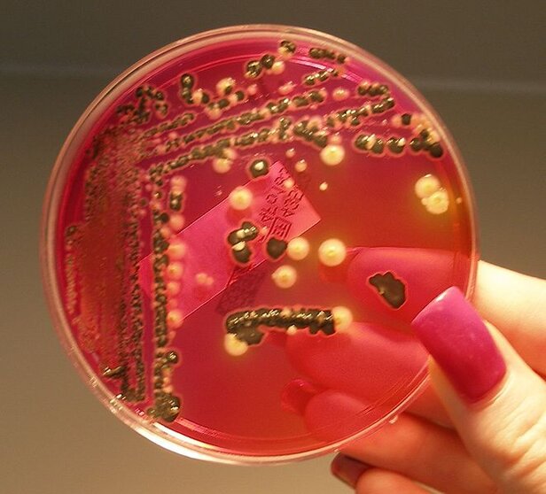 Salmonella_growing_on_XLD_agar