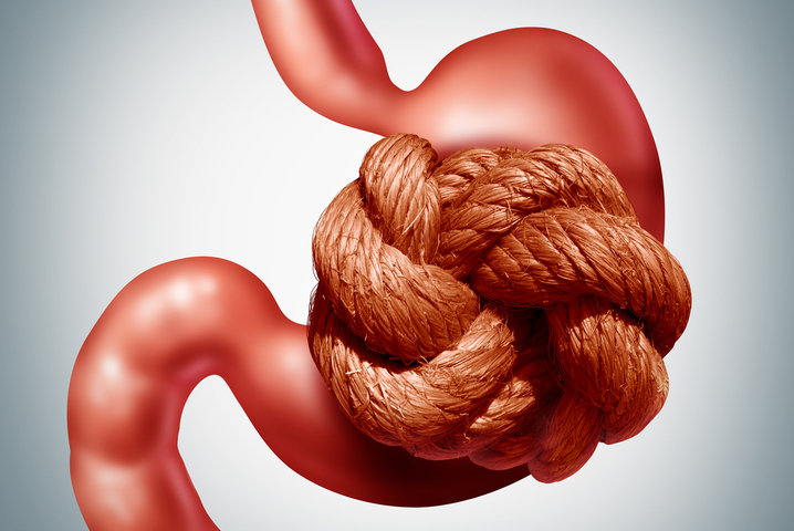 Imagen de un estómago con un nudo de cuerda