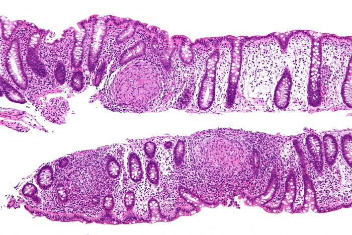 intestino