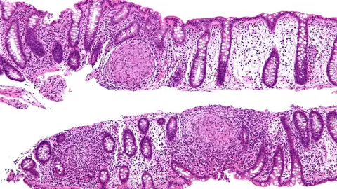 intestino
