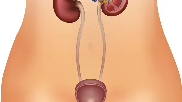 infección-tracto-urinario